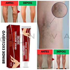 "Kit Pernas Fabulosas": Meia-Calça (Compre 1 Leve 2) e Ganhe um Creme para Varizes de Brinde!