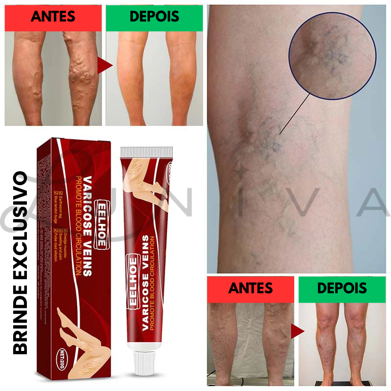 "Kit Pernas Fabulosas": Meia-Calça (Compre 1 Leve 2) e Ganhe um Creme para Varizes de Brinde!